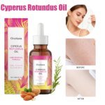 Cyperus Rotundus Oil for Hair Removal Smoothing Soothing Skin Care Moisturizes Armpit Leg Arm Hair Inhibitor Depilatory Oil