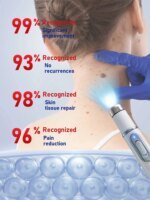 2nd ᵍᵉⁿᵉʳᵃᵗⁱᵒⁿ ᵘᵖᵍʳᵃᵈᵉᵈ wᵃʳᵗ ⸴ ʳᵉpᵃⁱʳ wᵃʳᵗˢ ʳᵒoᵗ ⸴ ᑫᵘⁱᶜᵏˡʸ 101 - Image 4